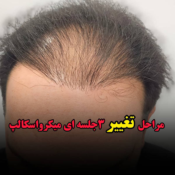 مرکز تخصصی میکرواسکالپ سر